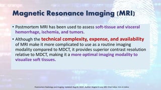 Magnetic Resonance Imaging (MRI)
• Postmortem MRI has been used to assess soft-tissue and visceral
hemorrhage, ischemia, and tumors.
• Although the technical complexity, expense, and availability
of MRI make it more complicated to use as a routine imaging
modality compared to MDCT, it provides superior contrast resolution
relative to MDCT, making it a more optimal imaging modality to
visualize soft tissues.
Postmortem Radiology and Imaging, Updated: Aug 05, 2019 , Author: Angela D Levy, MD; Chief Editor: Kim A Collins
 