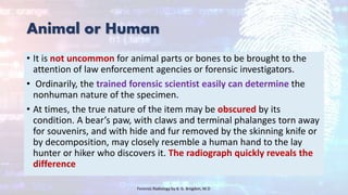 Animal or Human
• It is not uncommon for animal parts or bones to be brought to the
attention of law enforcement agencies or forensic investigators.
• Ordinarily, the trained forensic scientist easily can determine the
nonhuman nature of the specimen.
• At times, the true nature of the item may be obscured by its
condition. A bear’s paw, with claws and terminal phalanges torn away
for souvenirs, and with hide and fur removed by the skinning knife or
by decomposition, may closely resemble a human hand to the lay
hunter or hiker who discovers it. The radiograph quickly reveals the
difference
Forensic Radiology by B. G. Brogdon, M.D
 