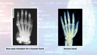 Bear paw mistaken for a human hand Human hand
 