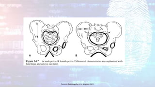 Forensic Radiology by B. G. Brogdon, M.D
 