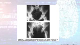 Forensic Radiology by B. G. Brogdon, M.D
 