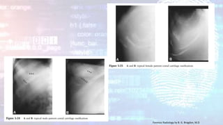 Forensic Radiology by B. G. Brogdon, M.D
 