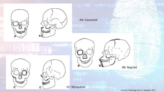 AA: Caucasoid
BB: Negroid
CC: Mongoloid
Forensic Radiology by B. G. Brogdon, M.D
 