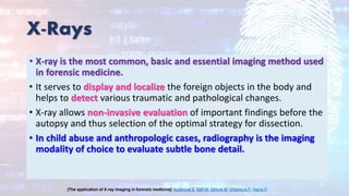 X-Rays
• X-ray is the most common, basic and essential imaging method used
in forensic medicine.
• It serves to display and localize the foreign objects in the body and
helps to detect various traumatic and pathological changes.
• X-ray allows non-invasive evaluation of important findings before the
autopsy and thus selection of the optimal strategy for dissection.
• In child abuse and anthropologic cases, radiography is the imaging
modality of choice to evaluate subtle bone detail.
[The application of X-ray imaging in forensic medicine]. Kučerová S, Safr M, Ublová M, Urbanová P, Hejna P.
 