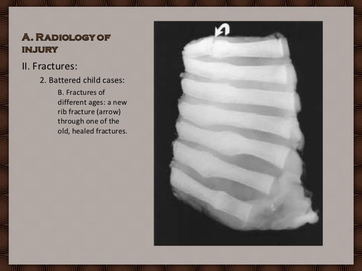 Forensic radiology practical under