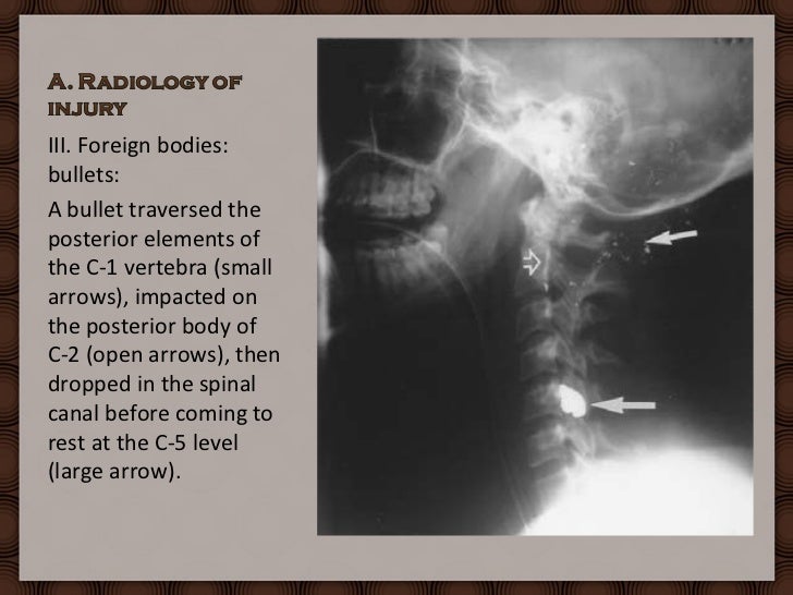 forensic radiology Journal of forensic radiology and imaging is published by elsevier and affiliated with the international society of forensic radiology and imaging and the. forensic radiology Journal of forensic radiology and imaging is published by elsevier and affiliated with the international society of forensic radiology and imaging and the.