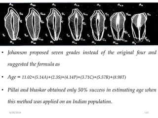 8/30/2018 110
• Johanson proposed seven grades instead of the original four and
suggested the formula as
• Age = 11.02+(5.14A)+(2.3S)+(4.14P)+(3.71C)+(5.57R)+(8.98T)
• Pillai and bhaskar obtained only 50% success in estimating age when
this method was applied on an Indian population.
 