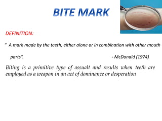 DEFINITION:
“ A mark made by the teeth, either alone or in combination with other mouth
parts”. - McDonald (1974)
Biting is a primitive type of assualt and results when teeth are
employed as a weapon in an act of dominance or desperation
 