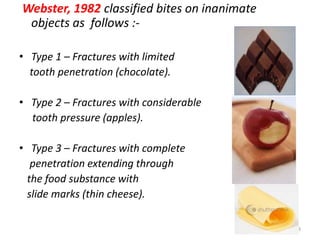 Webster, 1982 classified bites on inanimate
objects as follows :-
• Type 1 – Fractures with limited
tooth penetration (chocolate).
• Type 2 – Fractures with considerable
tooth pressure (apples).
• Type 3 – Fractures with complete
penetration extending through
the food substance with
slide marks (thin cheese).
123
 