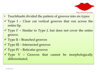 8/30/2018
• Tsuchihashi divided the pattern of grooves into six types:
 Type I – Clear cut vertical grooves that run across the
entire lip.
 Type I’ – Similar to Type I, but does not cover the entire
groove.
 Type II – Branched grooves
 Type III – Intersected grooves
 Type IV – Reticular grooves
 Type V – Grooves that cannot be morphologically
differentiated.
 