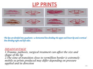 LIP PRINTS
140
DISADVANTAGE
1.Trauma, pathosis, surgical treatment can affect the size and
shape of the lip
2.The zone of transition close to vermillion border is extremely
mobile so prints produced may differ depending on pressure
applied and its direction
The lips are divided into quadrants –a horizontal line dividing the upper and lower lip and a vertical
line dividing right and left sides.
 