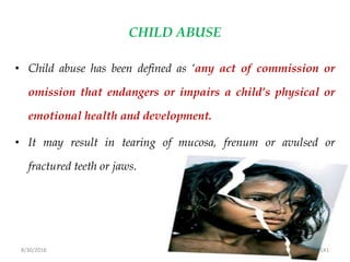 8/30/2018 141
CHILD ABUSE
• Child abuse has been defined as ‘any act of commission or
omission that endangers or impairs a child’s physical or
emotional health and development.
• It may result in tearing of mucosa, frenum or avulsed or
fractured teeth or jaws.
 