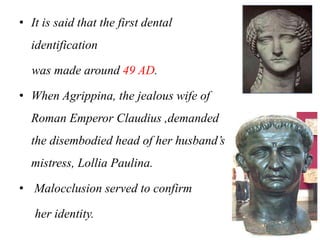 • It is said that the first dental
identification
was made around 49 AD.
• When Agrippina, the jealous wife of
Roman Emperor Claudius ,demanded
the disembodied head of her husband’s
mistress, Lollia Paulina.
• Malocclusion served to confirm
her identity.
17
 