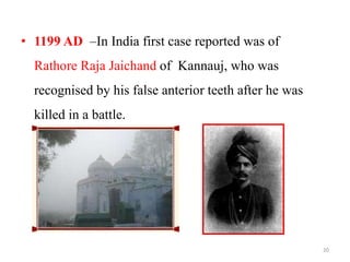 • 1199 AD –In India first case reported was of
Rathore Raja Jaichand of Kannauj, who was
recognised by his false anterior teeth after he was
killed in a battle.
20
 