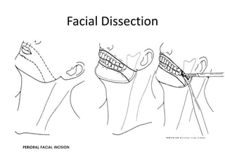 Facial Dissection
 