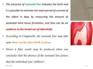 8/30/2018 96
• The presence of neonatal line indicates live birth and
it is possible to estimate the exact period of survival of
the infant in days by measuring the amount of
postnatal hard tissue formation, and thus can be an
evidence to the brutal act of infanticide.
• According to Ciapparelli, the neonatal line may take
upto three weeks after birth to form.
• Hence a false result may be produced when one
concludes that the absence of the neonatal line proves
that the individual was ‘stillborn’.
 