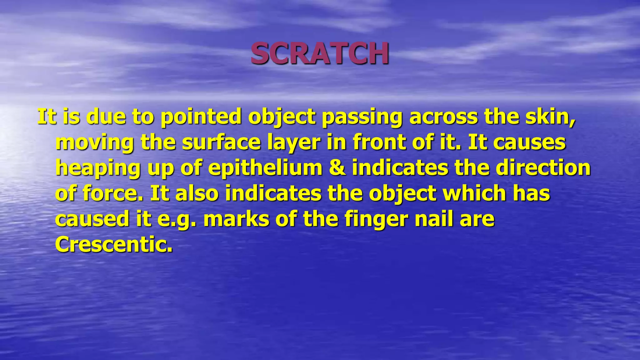 SCRATCH
It is due to pointed object passing across the skin,
moving the surface layer in front of it. It causes
heaping up of epithelium & indicates the direction
of force. It also indicates the object which has
caused it e.g. marks of the finger nail are
Crescentic.
 