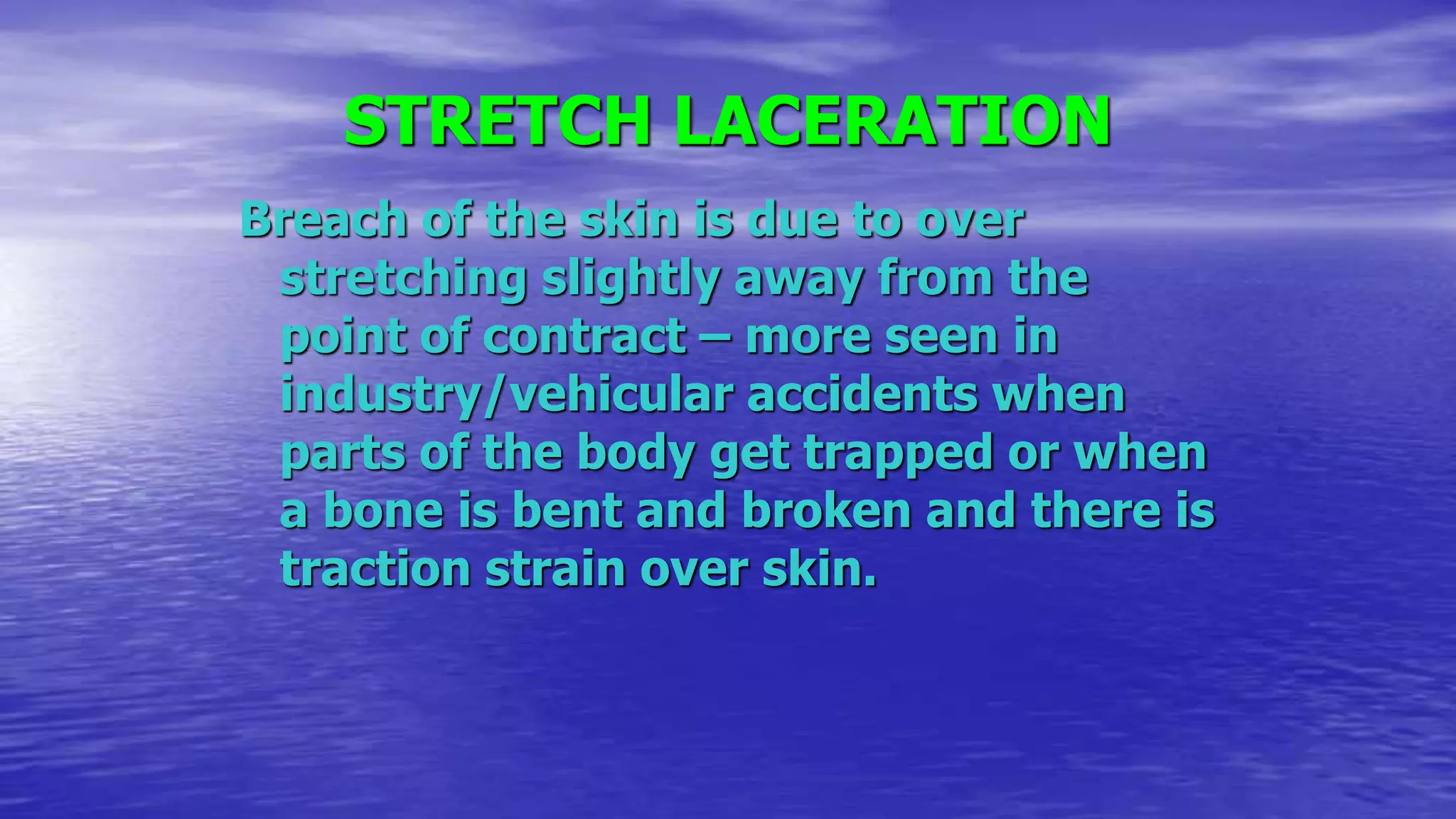 STRETCH LACERATION
Breach of the skin is due to over
stretching slightly away from the
point of contract – more seen in
industry/vehicular accidents when
parts of the body get trapped or when
a bone is bent and broken and there is
traction strain over skin.
 