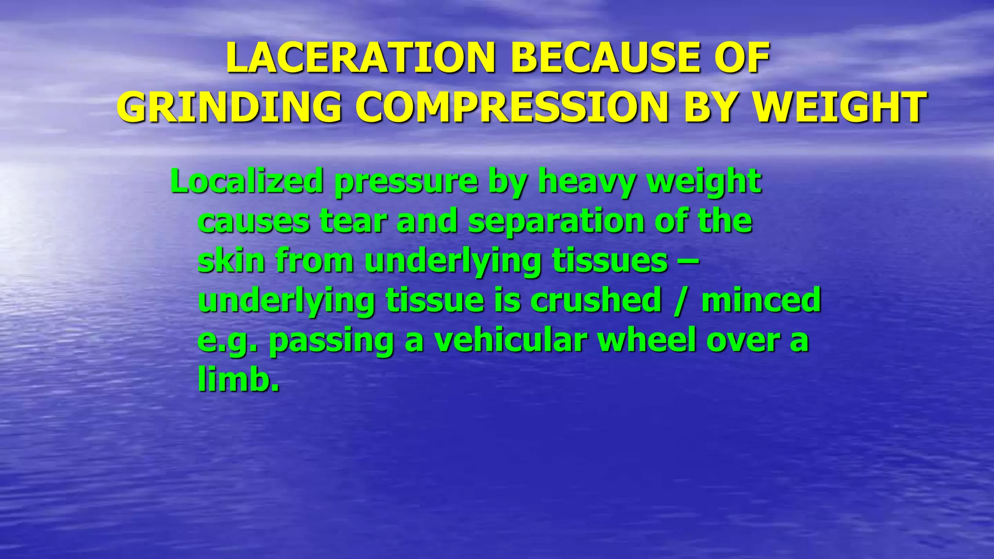 LACERATION BECAUSE OF
GRINDING COMPRESSION BY WEIGHT
Localized pressure by heavy weight
causes tear and separation of the
skin from underlying tissues –
underlying tissue is crushed / minced
e.g. passing a vehicular wheel over a
limb.
 