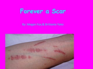 Forever a Scar
By: Megan Fox,& Brittanie Yoke
 