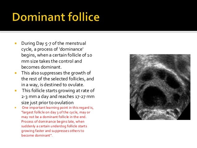 what is dominant follicle size