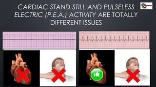 CARDIAC STAND STILL AND PULSELESS
ELECTRIC (P.E.A.) ACTIVITY ARE TOTALLY
DIFFERENT ISSUES
 