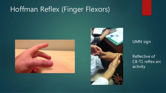 Forgotten reflex testing