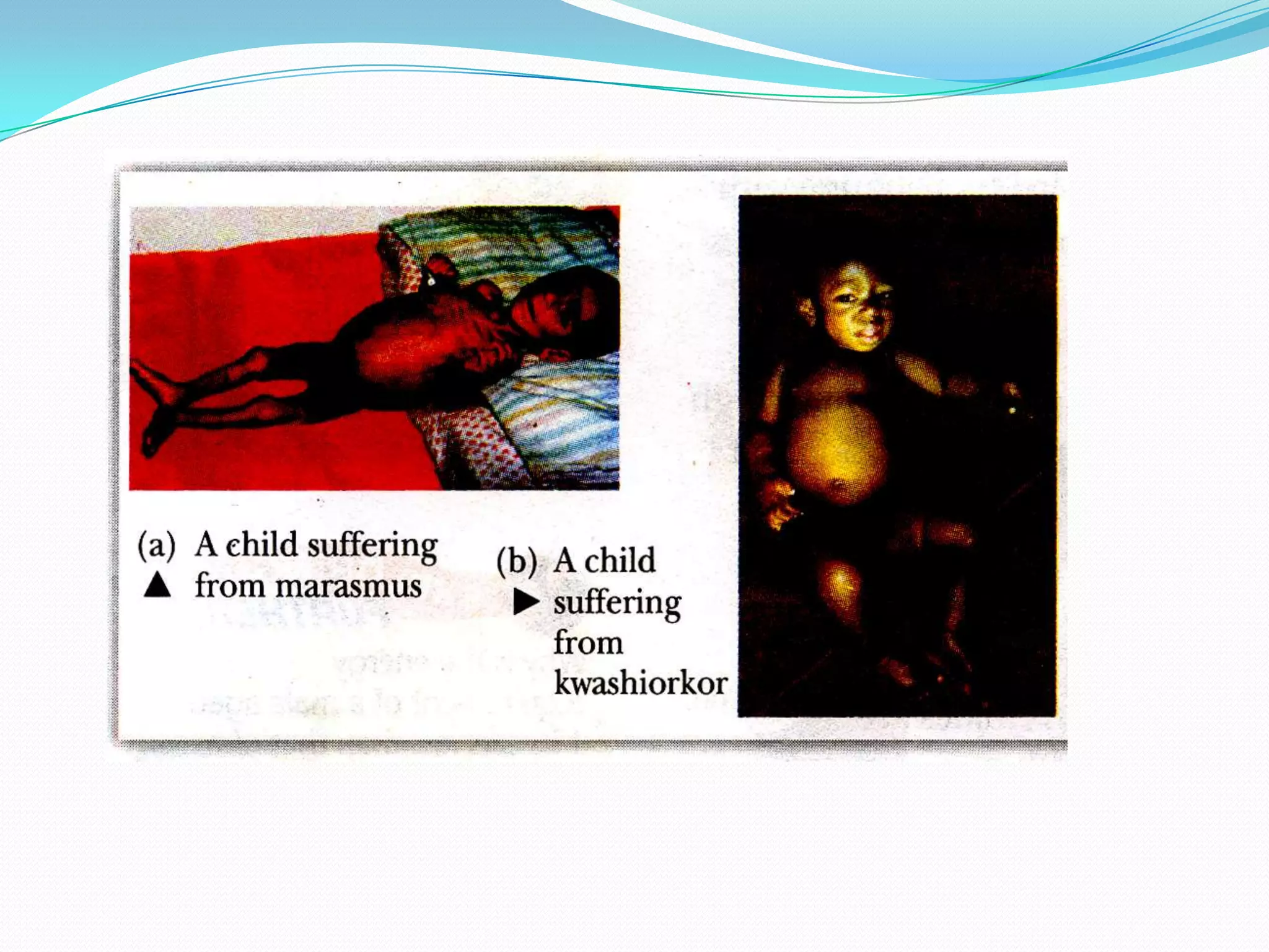 When adults get older, they stop growing and their metabolic rates drop.