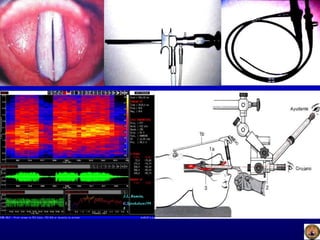 J.L. Ramón,
C.Sprekelsen199
8
 