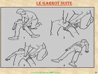 23
Les gestes qui sauvent, DRPC Kayes
LE GARROT suite
 
