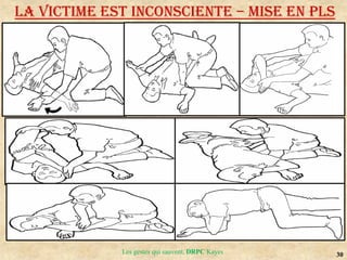 30
Les gestes qui sauvent, DRPC Kayes
LA VICTIME EST INCONSCIENTE – MISE EN PLS
 