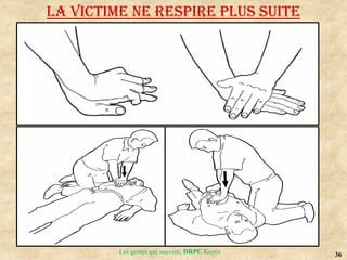 36
Les gestes qui sauvent, DRPC Kayes
LA VICTIME NE RESPIRE PLUS SUITE
 