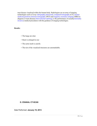 treat disease visualized within the human body. Radiologists use an array of imaging
technologies such as X-ray radiography,ultrasound, computed tomography (CT), nuclear
medicine,positron emission tomography (PET) and magnetic resonance imaging (MRI) to
diagnose or treat diseases.Interventional radiology is the performance of (usuallyminimally
invasive) medical procedures with the guidance of imaging technologies.
Results:
> The lungs are clear
> Heart is enlarged in size
> The aortic knob is calcific
> The rest of the visualized structures are unremarkable.
D. CRANIAL CT-SCAN
Date Performed: January 19, 2013
35 | Page
 