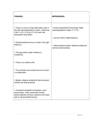 FINDINGS: IMPRESSIONS:
> There is a focus of high-attenuation seen in
the right capsuloganglionic region, measuring
2.95 x 1.47 x 3.18 cm (7.17cc) with mild
associated mass effect.
> Small-hypodense focus is noted in the right
thalamus
> The gray-white matter interface is
maintained.
> There is no midline shift.
> The ventricles and cortical sulci are normal
in configuration.
> Basilar, bilateral vertebral & internal carotid
arteries are atherosclerotic.
> Visualized cerebellar hemisphere, pons,
pineal region, orbits, paranasal sinuses,
pestromastoids and bony calvarium are intact
with no demonstrable fracture.
> Acute intracerebral hemorrhage, Right
capsuloganglionic region (7.17 cc)
> Lacunar infarct, Right thalamus
> Atherosclerotic basilar, bilateral vertebral &
internal carotid arteries
36 | Page
 