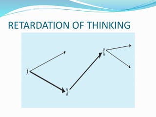 RETARDATION OF THINKING
 