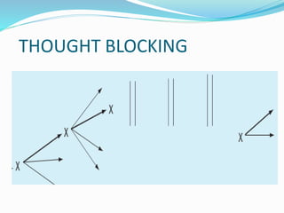 THOUGHT BLOCKING
 