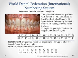 World Dental Federation (International) 
Numbering System 
17 
Fédération Dentaire Internationale (FDI) 
This system numbers each quadrant 
with a number – #1 Maxillary R, #2 
Maxillary L, #3 Mandibular L, #4 
Mandibular R followed by the tooth 
number 1-8 starting with the central 
incisors. 
Example: Upper Right Canine = 13, 
Upper Left Canine = 23, etc. 
Primary teeth are prefixed with 5 for upper right, 6 for upper left, 7 for 
lower left, and 8 for lower right. 
Example: Lower left canine would be 73 
Photo 
 