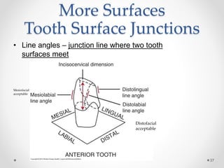 More Surfaces 
Tooth Surface Junctions 
• Line angles – junction line where two tooth 
surfaces meet 
37 
Mesiofacial 
acceptable 
Distofacial 
acceptable 
 