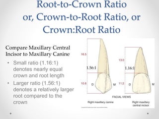 Root-to-Crown Ratio 
or, Crown-to-Root Ratio, or 
Crown:Root Ratio 
Compare Maxillary Central 
Incisor to Maxillary Canine 
• Small ratio (1.16:1) 
denotes nearly equal 
crown and root length 
• Larger ratio (1.56:1) 
denotes a relatively larger 
root compared to the 
crown 
1.56:1 1.16:1 
 