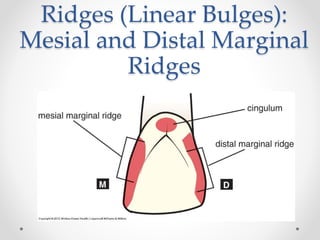 Ridges (Linear Bulges): 
Mesial and Distal Marginal 
Ridges 
 