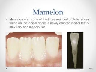Mamelon 
• Mamelon – any one of the three rounded protuberances 
found on the incisal ridges a newly erupted incisor teeth-maxillary 
and mandibular 
75 
 