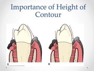 Importance of Height of 
Contour 
 
