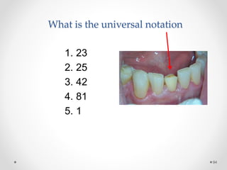 What is the universal notation 
94 
1. 23 
2. 25 
3. 42 
4. 81 
5. 1 
 