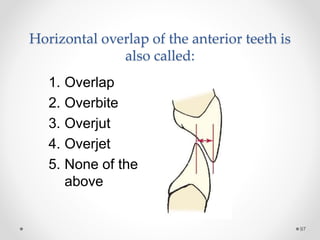 97 
Horizontal overlap of the anterior teeth is 
also called: 
1. Overlap 
2. Overbite 
3. Overjut 
4. Overjet 
5. None of the 
above 
 