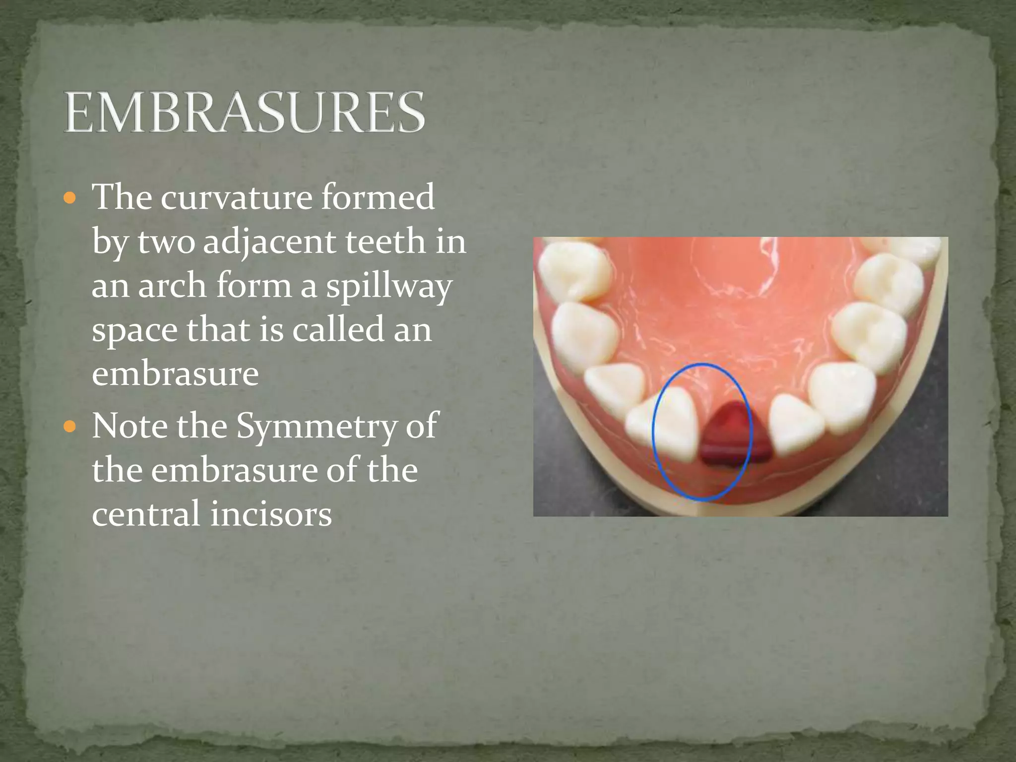  The curvature formed
by two adjacent teeth in
an arch form a spillway
space that is called an
embrasure
 Note the Symmetry of
the embrasure of the
central incisors
 