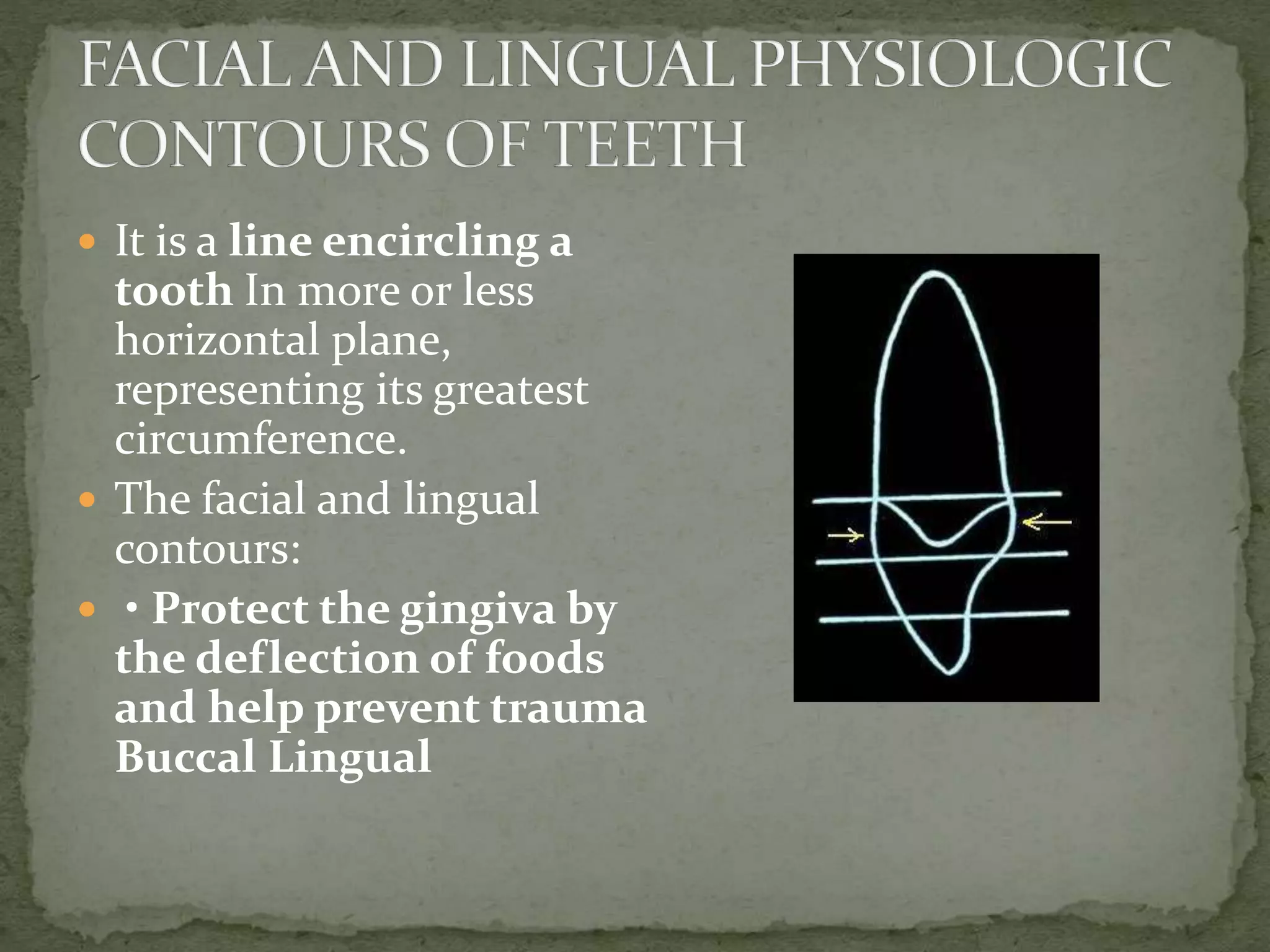  It is a line encircling a
tooth In more or less
horizontal plane,
representing its greatest
circumference.
 The facial and lingual
contours:
 • Protect the gingiva by
the deflection of foods
and help prevent trauma
Buccal Lingual
 