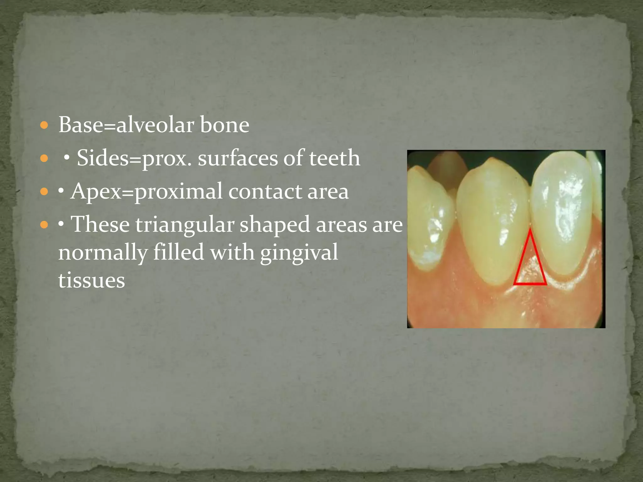  Base=alveolar bone
 • Sides=prox. surfaces of teeth
 • Apex=proximal contact area
 • These triangular shaped areas are
normally filled with gingival
tissues
 