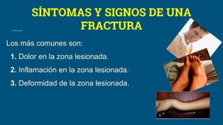 SÍNTOMAS Y SIGNOS DE UNA
FRACTURA
Los más comunes son:
1. Dolor en la zona lesionada.
2. Inflamación en la zona lesionada.
3. Deformidad de la zona lesionada.
 