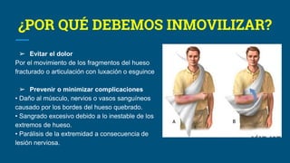 ¿POR QUÉ DEBEMOS INMOVILIZAR?
➢ Evitar el dolor
Por el movimiento de los fragmentos del hueso
fracturado o articulación con luxación o esguince
➢ Prevenir o minimizar complicaciones
• Daño al músculo, nervios o vasos sanguíneos
causado por los bordes del hueso quebrado.
• Sangrado excesivo debido a lo inestable de los
extremos de hueso.
• Parálisis de la extremidad a consecuencia de
lesión nerviosa.
 
