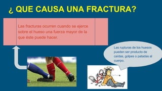 ¿ QUE CAUSA UNA FRACTURA?
l Las fracturas ocurren cuando se ejerce
sobre el hueso una fuerza mayor de la
que éste puede hacer.
Las rupturas de los huesos
pueden ser producto de
caídas, golpes o patadas al
cuerpo.
 